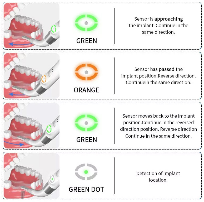 YAHOPE iD1 Dental Implant Detector Implant Abutment Locator Smart 360° Rotating Sensor 